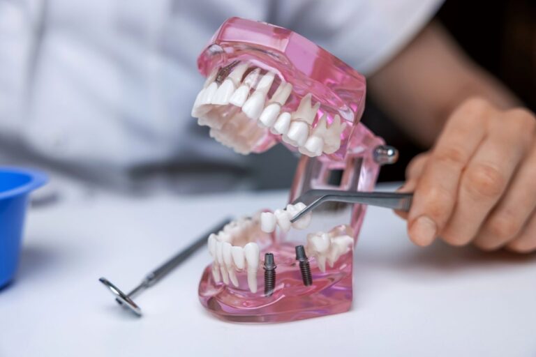 Jakie narzedzia sa niezbedne w nowoczesnej implantologii